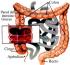 FOS para el cuidado del intestino